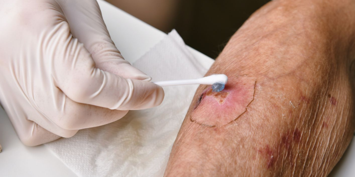 Bild zum Kurs 09.06.2026 | Palliative Wundbehandlung | Copyright: canva-gettyimages